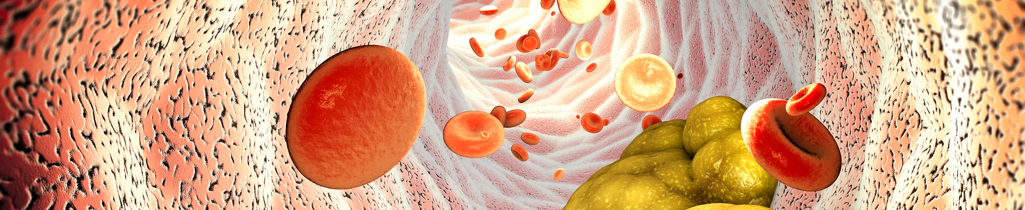 Heart-Health-Spotlight-Lipoprotein(a)-Header